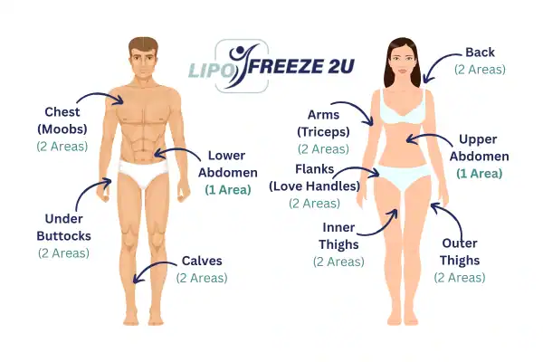 Areas you can have fat freezing treatment Edgware