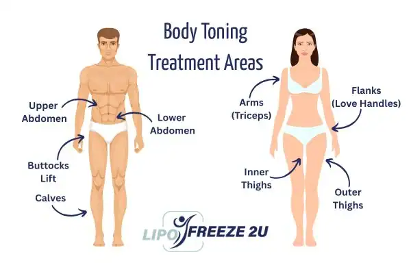 Graphic showing where you can have Body toning Treatment Edgware on your body