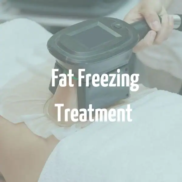 fat freezing treatment Edgware