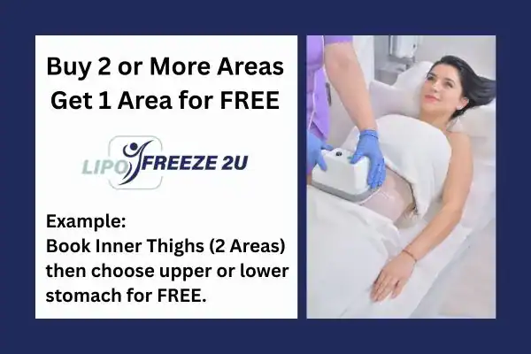 fat freezing prices Edgware